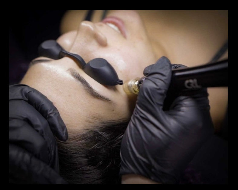 Microneedling and Coven’s Awakening Growth Factor Serum: A Ritual of Renewal